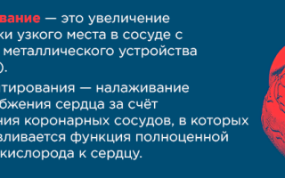 Как устанавливают стент в сердце
