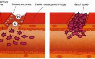Процесс свертывания крови у человека