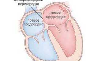 Инсульт операция на голове последствия