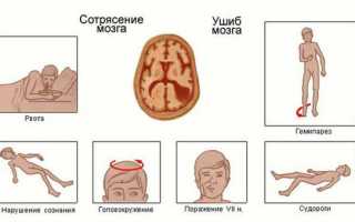 Травма головы последствия со временем у взрослых