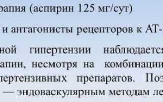 Извитость экстракраниальных отделов позвоночных артерий