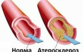 Питание для эластичности сосудов