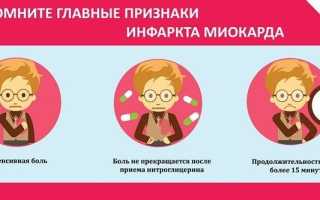 Характерные симптомы инфаркта миокарда