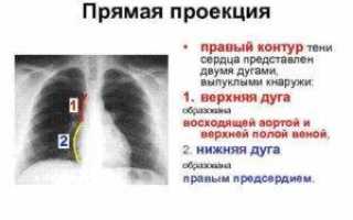 Правый контур сердца