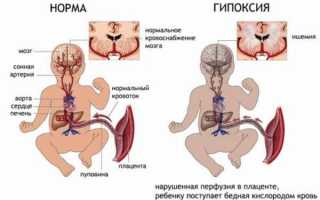 Эмбриональный гемоглобин