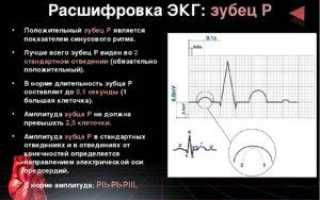 Расшифровка экг онлайн с вводом данных бесплатно