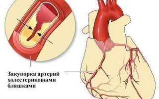 Какой уровень холестерина считается нормой у взрослых