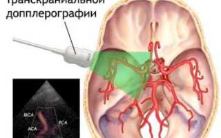 Флебография вен малого таза