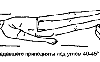 Сердечно легочную реанимацию начинают