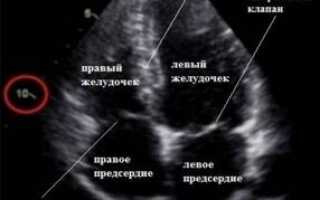 Узи сердца показатели нормы расшифровка