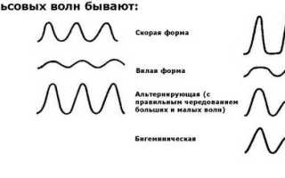 Экстрасистолы ночью