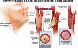 Самый безопасный статин