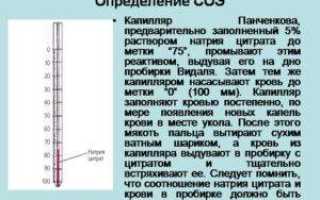 Соэ по панченкову повышены у взрослого