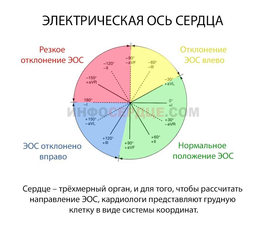 Эос отклонена вправо у ребенка что это