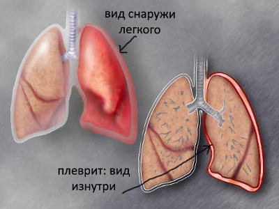 Сильно болит правый бок отдает в спину