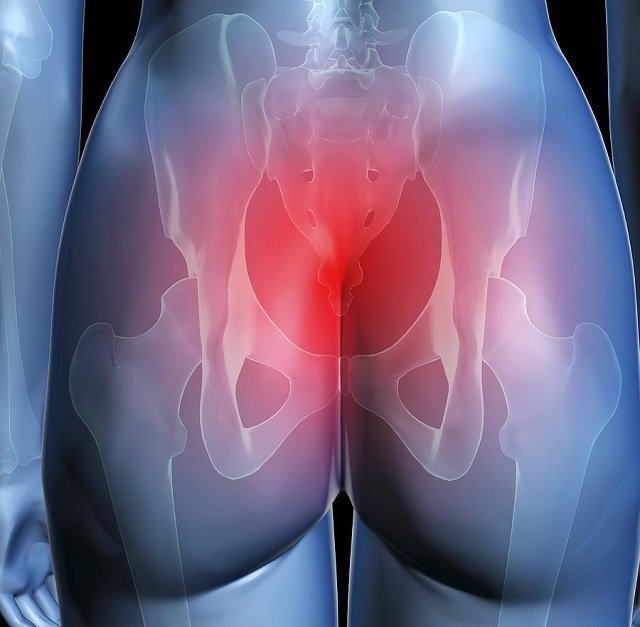 Болит копчик к какому врачу обратиться