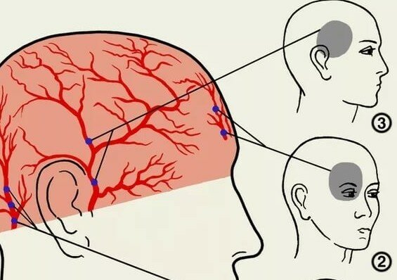 болит голова устают глаза