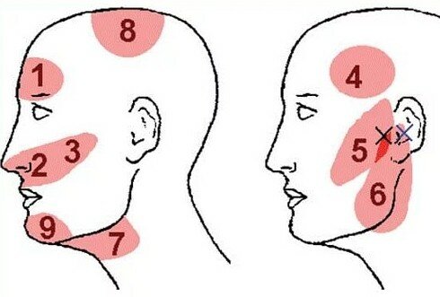 болит голова в области висков а температуры нет