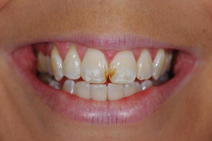 болит зуб болит голова