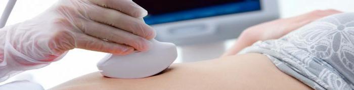 боли при внематочной беременности