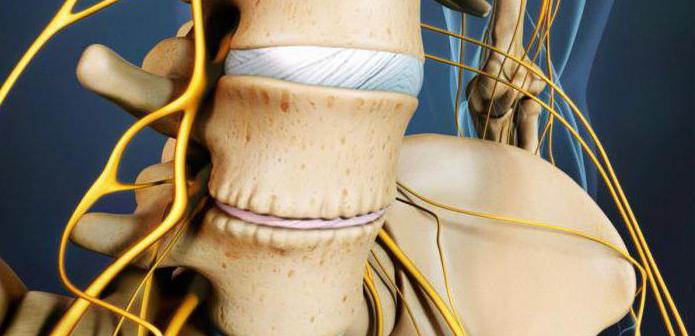 почему болит спина когда встаю с постели