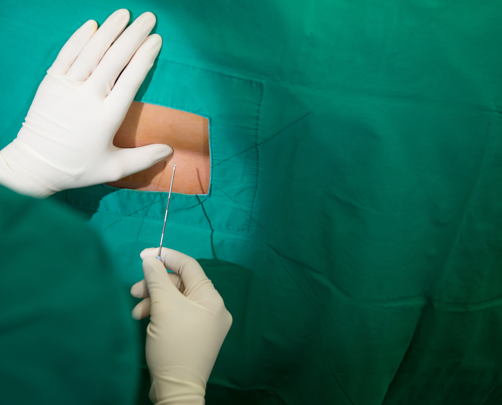 Проведение блокады