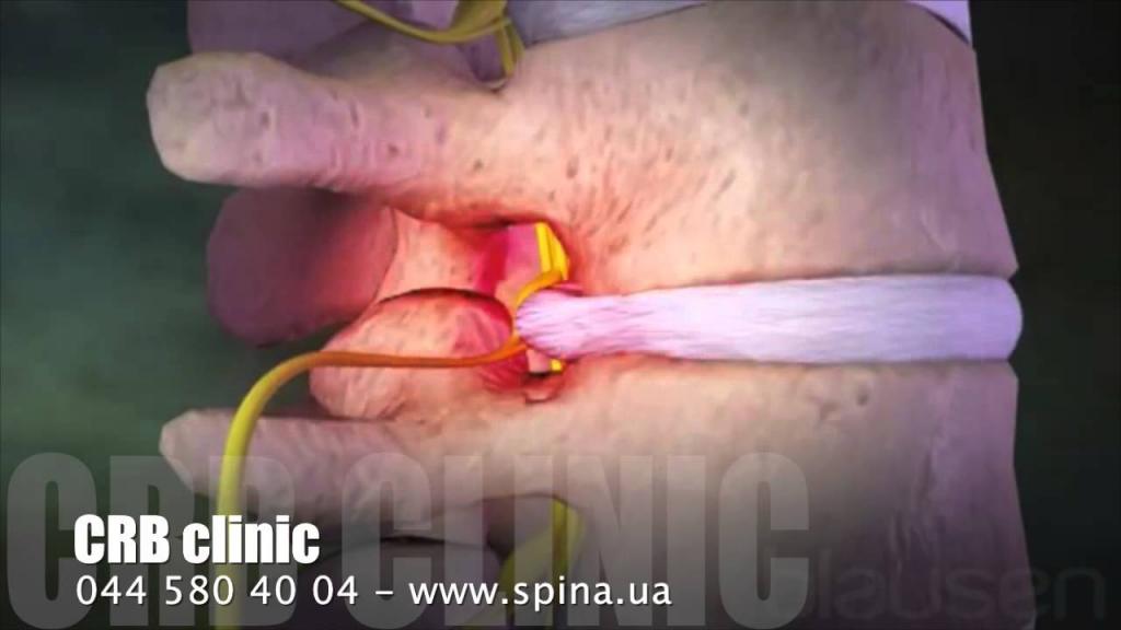 Болит нижняя часть спины почему