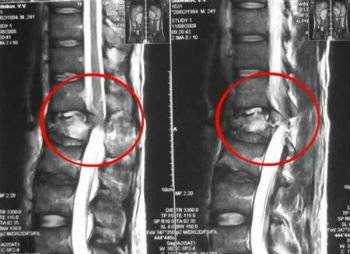 Когда наклоняю голову вниз болит поясница
