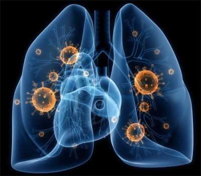 Сильно болит правый бок отдает в спину