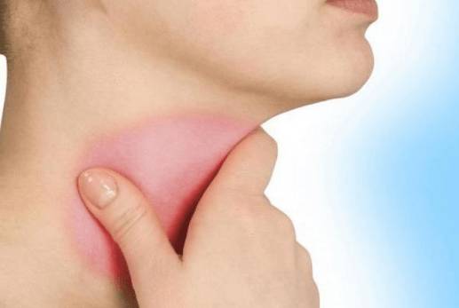 Летом болит горло и голова