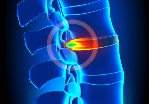 болит спина в лопатках и шее