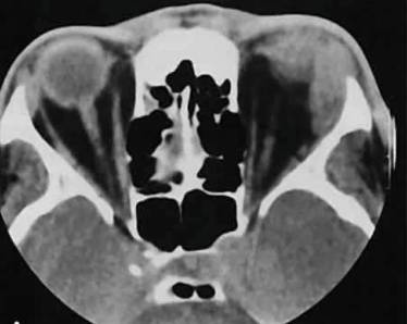 болит вся спина от поясницы до шеи и температура