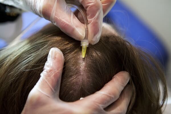 Болит кожа головы и выпадают волосы что это может быть