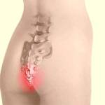 Если болит спина в области копчика к какому врачу