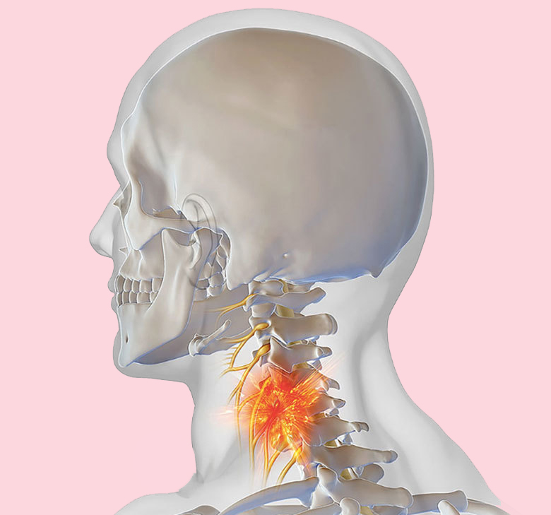 Изометрические упражнения от боли шее и головной боли Изометрические упражнения от боли шее и головной боли