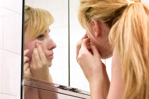 Как избавиться от прыщей на висках