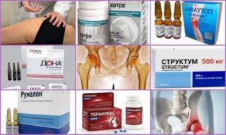 Если болит спина в области ключиц