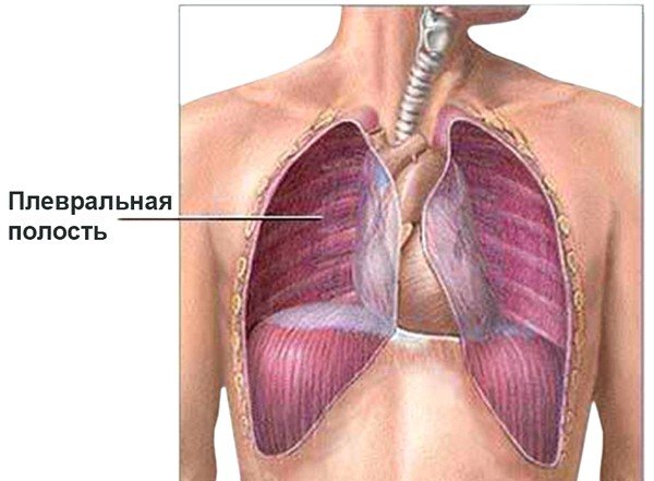 При правостороннем сухом плеврите происходит воспаление правых плевральных лепестков с последующим образованием на их поверхности фибрина