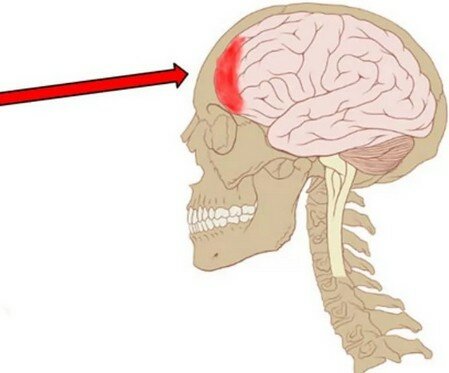 если болит лобная часть головы