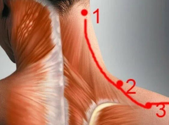 Болит голова и шея к какому врачу идти