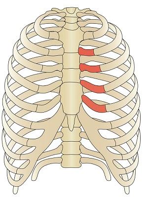 болят ребра со спины тяжело дышать
