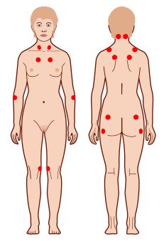 болят ребра со спины тяжело дышать