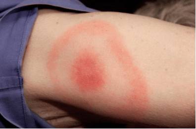 Болит голова и слабость в теле давление