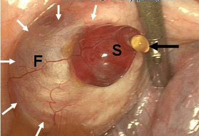 В первые дни цикла болит спина