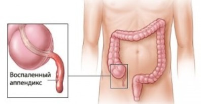 Болит желудок озноб болит голова