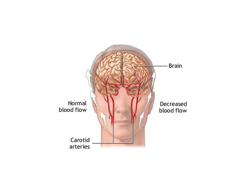 Если голова болит от погоды: Что делать Если голова болит от погоды: Что делать