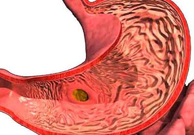 Болит желудок озноб болит голова