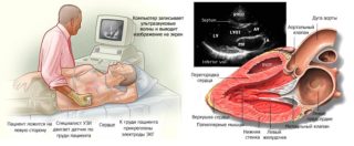 болят мышцы грудины и спины
