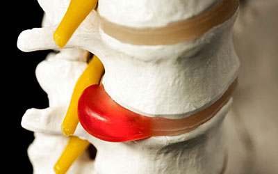 болят ребра со спины тяжело дышать