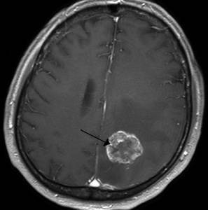 Болит голова и слабость в теле давление